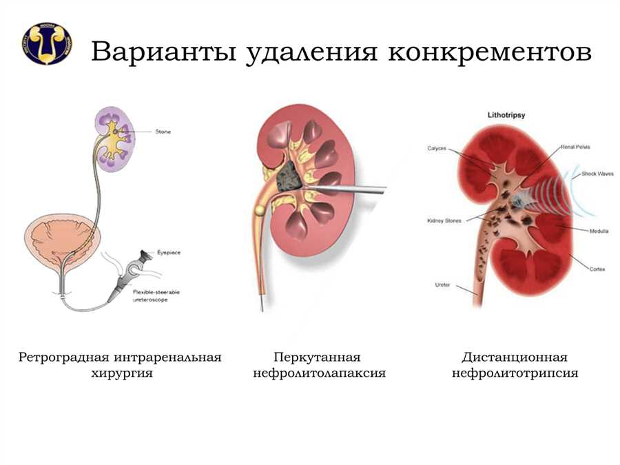 Лечение