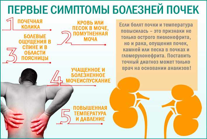 Выделение
