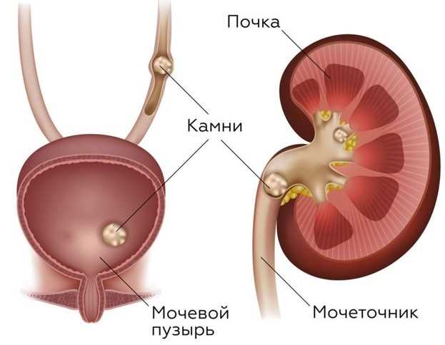 Фильтрация