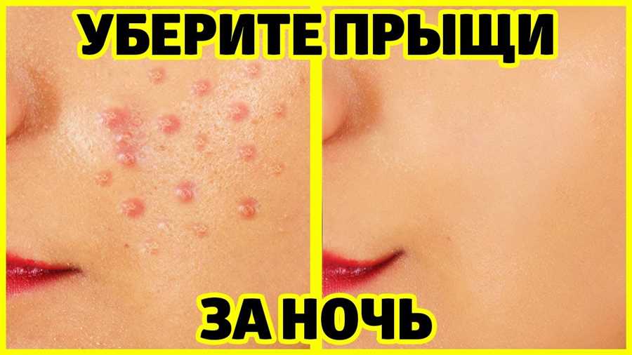 Использовать