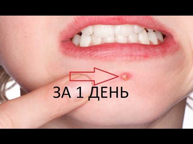 Избавиться