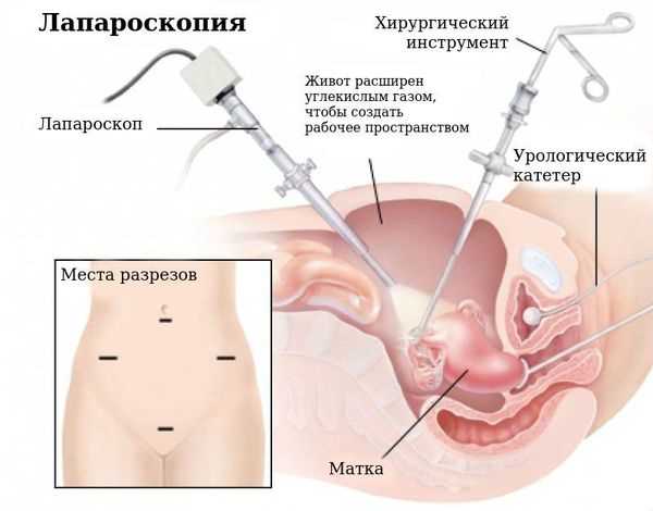 2.
