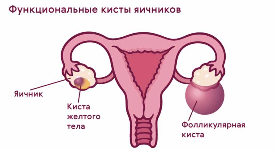 1.