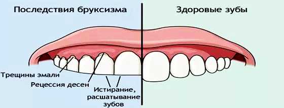 1.