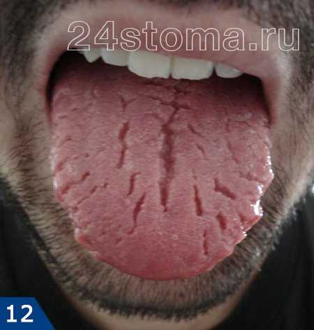 Избыточное