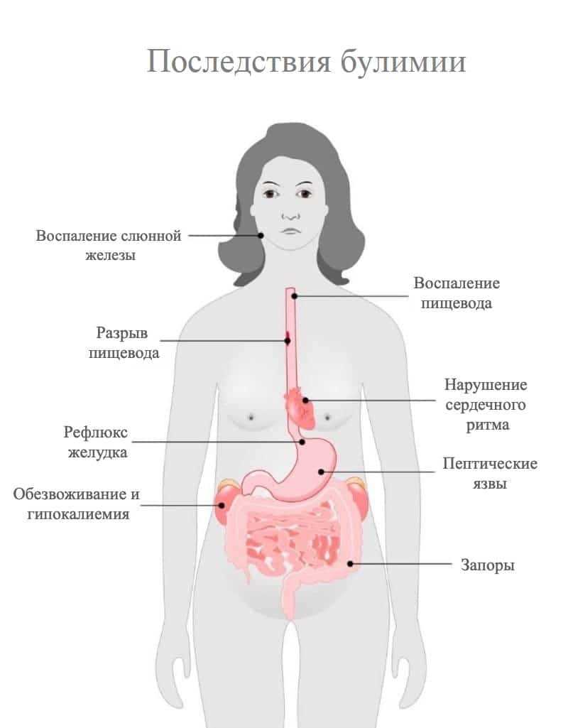 Рппп