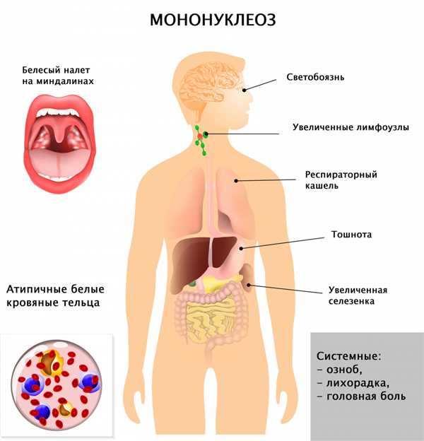 Серьезность