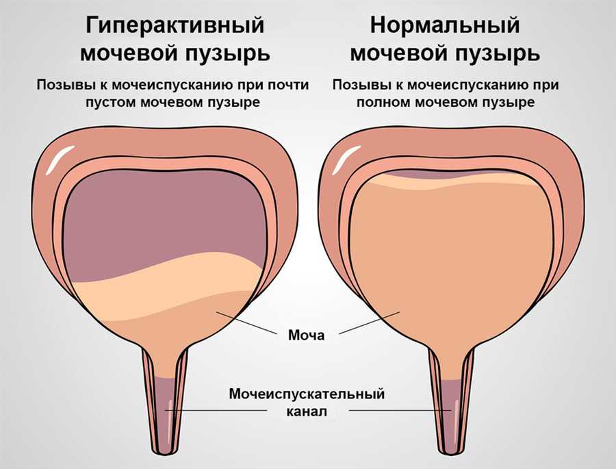 Как
