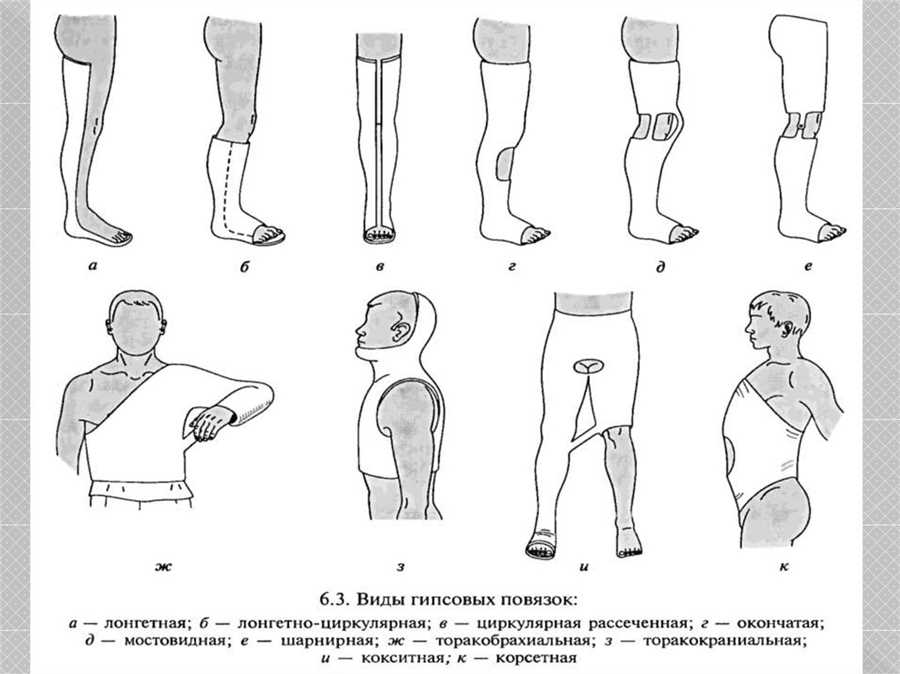 Особенности
