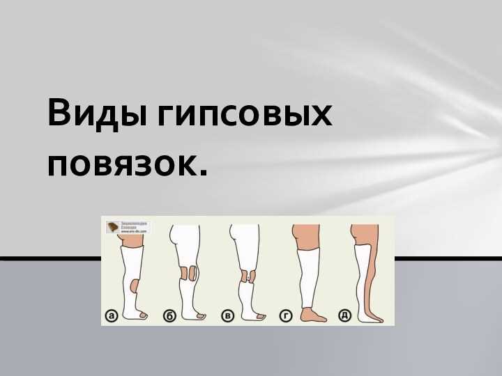 Гипсовые