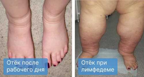 1.