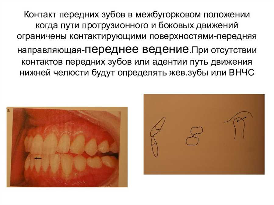 1.