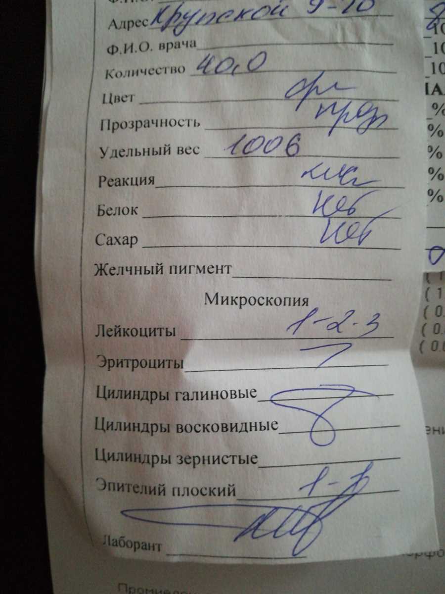 Подготовка