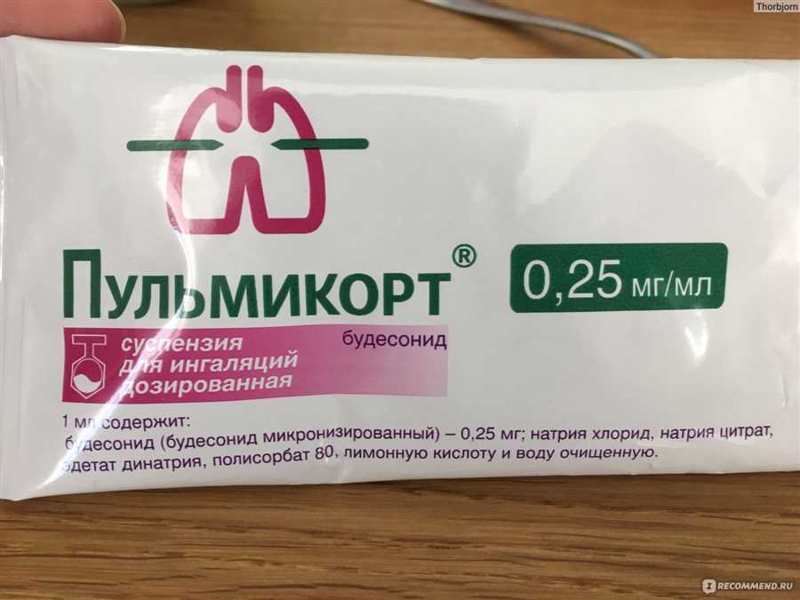 Особенности